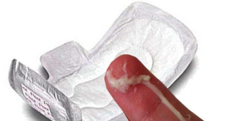 Творожные выделения у женщин: причины, как лечить в домашних