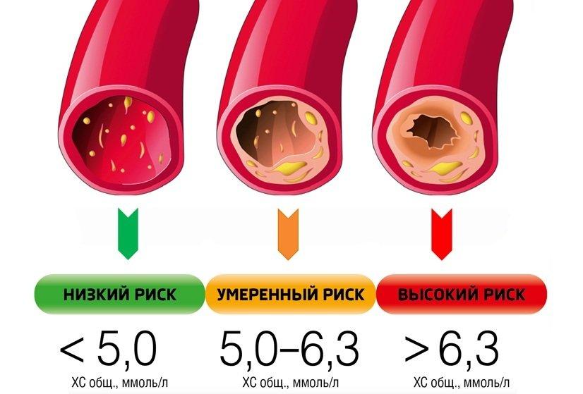 Советы врачей: что кушать для очистки сосудов от холестерина