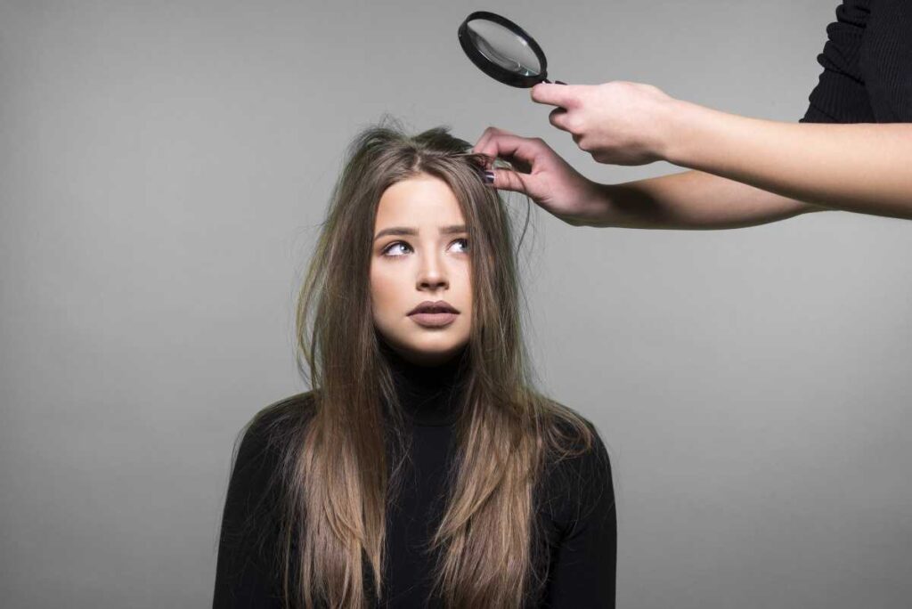 Снимают зуд и воспаление: 3 натуральных средства от перхоти