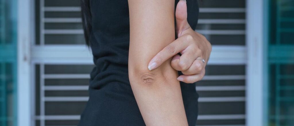 От сухости к бархатистости: как ухаживать за кожей на локтях