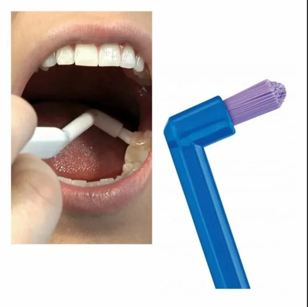 Монопучковая щетка: как правильно чистить зубы с ее помощью