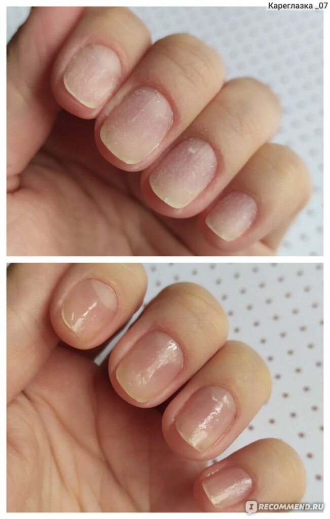 Как восстановить ногти после гель-лака: 3 важных шага