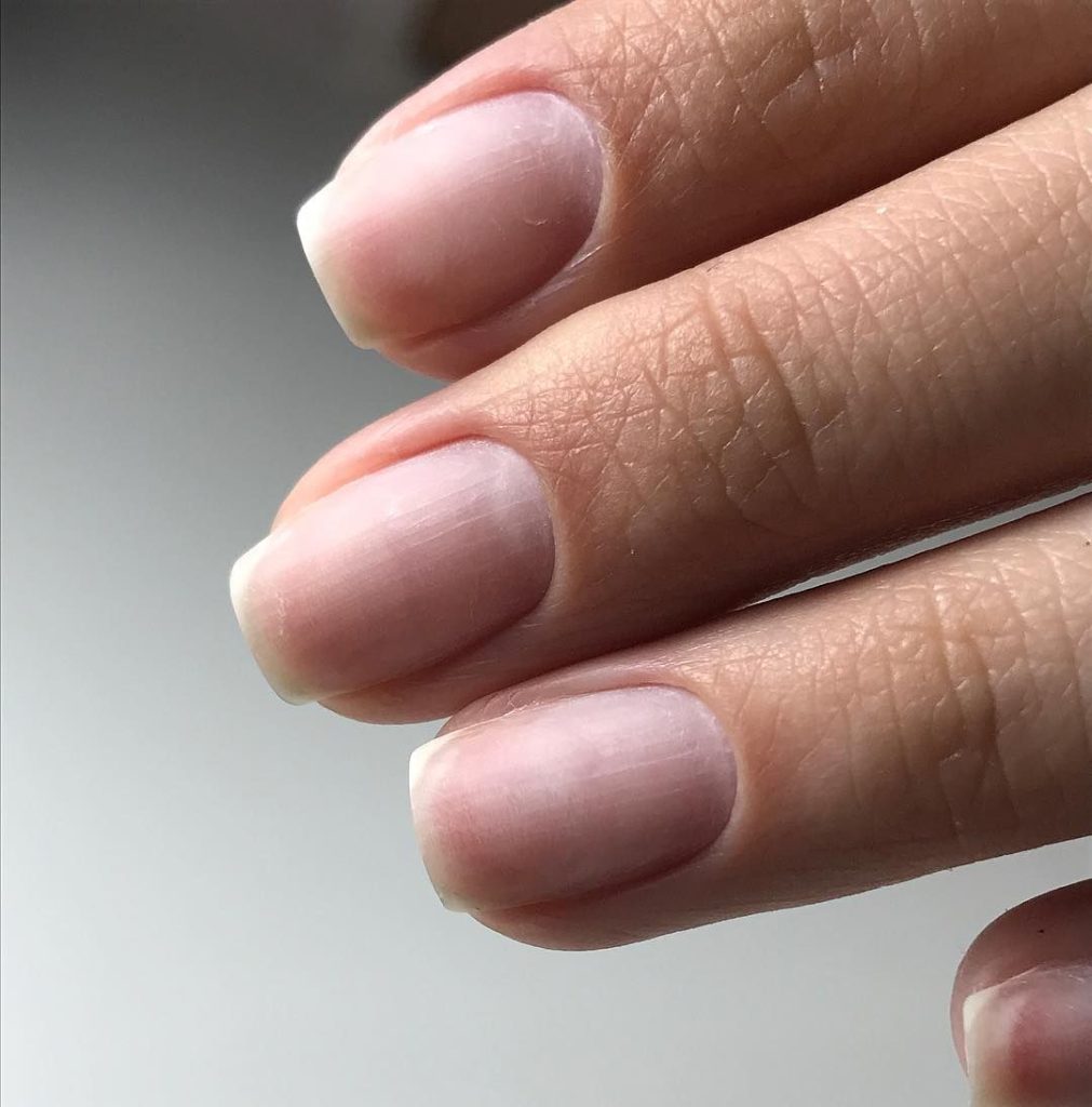 Крепче стали: работают ли средства для укрепления ногтей