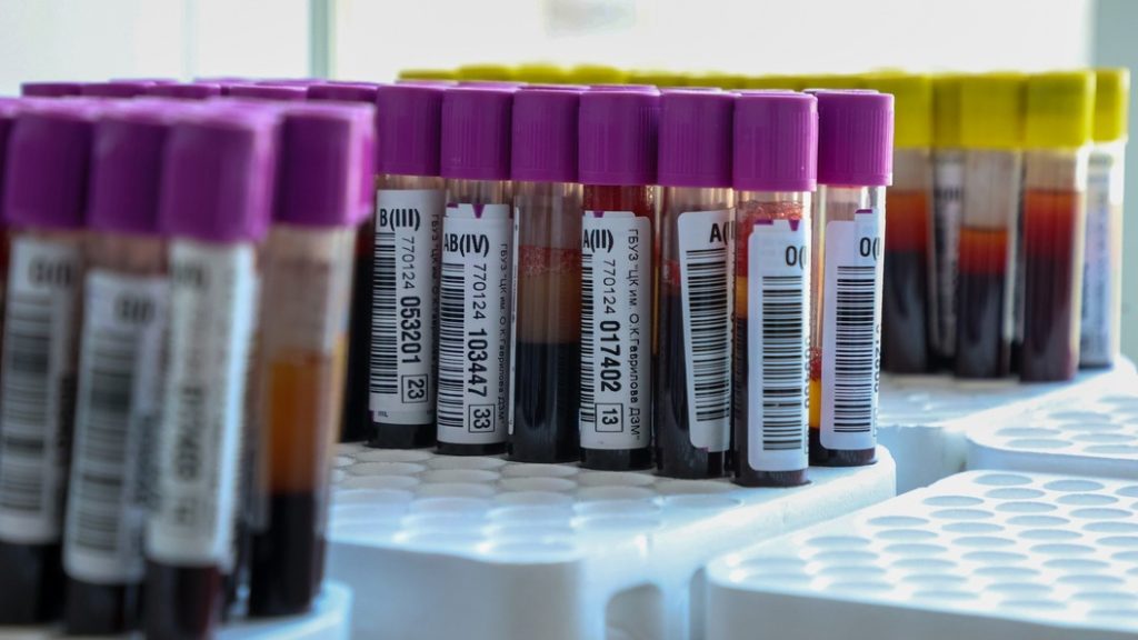 Три бесполезных анализа: что лучше сделать вместо них, рекомендует врач